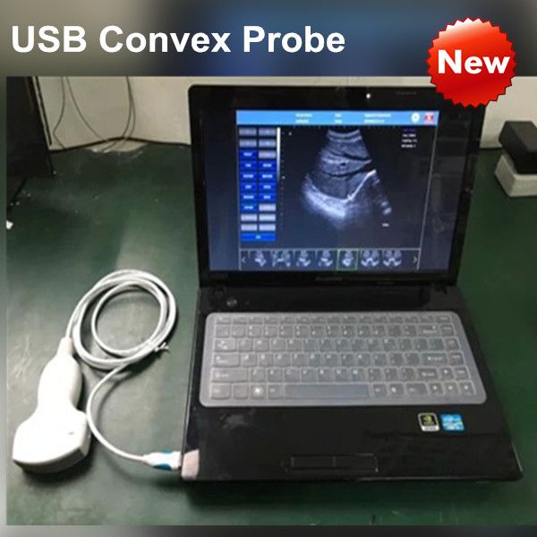 USB Ultrasound Probe+ultrasound Software, Ultrasound Scanner Wireless Probe Connect Any Computer