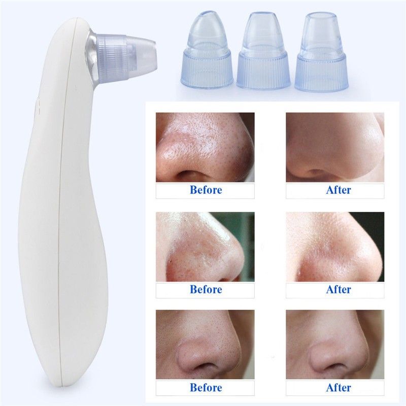 blackhead vacuum top rated blackhead remover machine buy online in pakistan