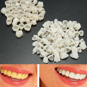 120 piezas de material dental, dientes, corona temporal mixta, 70 piezas, dientes delanteros anteriores, 50 piezas, carillas molares posteriores, herramienta para el cuidado de los dientes 231219