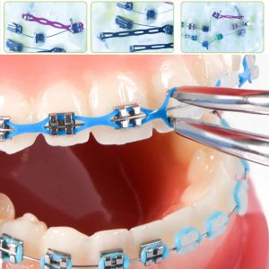 Cadena de potencia dental de 15 pies/rollo ortodoncia ultra ultra potencia de la banda de goma de la cadena de energía