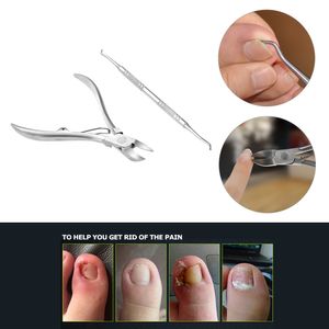 2 pièces en acier inoxydable ongles cuticules ciseaux incarné ongle nettoyant doigt et orteil coupe-ongles pince manucure pédicure outil