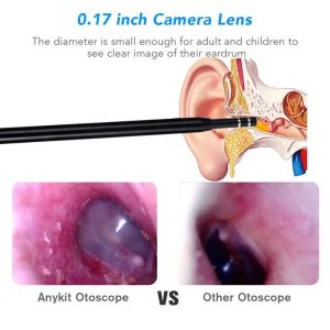 3,9 mm Otoscope Digital Medico 3 en 1 Endoscope de nettoyage USB Endoscope 720p Mini Ear Scope Caméra pour Type C Android Phone PC Windows