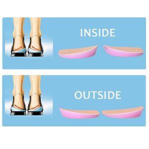 Orthotics INSOL FLATFOOT DESTEKLEYİCİ Sekiz ayak parmağı varus ayağı ortotik düzeltme ayakkabıları ek xo tipi bacaklar yastık pedleri