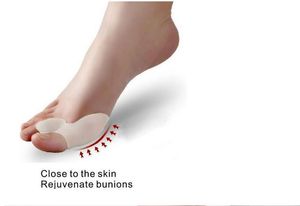 2 Adet / grup Silikon Bunion Toe Serpme Footmat Toe Halluks Valgus Düzeltici Silikon Jel Serpme Ayak Bakımı Bunion Guard Toe Sedye Straigh