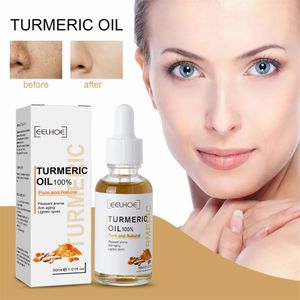 30 ml d'huile de curcuma soins de la peau pour éclaircir l'acné patchs foncés acné peau brillante correcteur de taches foncées Anti-âge visage blanchissant sérum soin