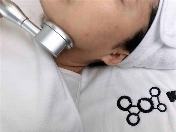 fractional rf scar removal machine microneedle rf ace removal machine radio frequency rf face lifting machine
fractional rf scar removal machine microneedle rf ace removal machine radio frequency rf face lifting machine
