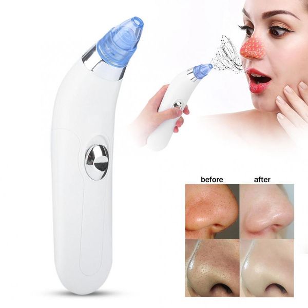 electric vacuum suction blackhead removal machine face skin cleaner device remove dead skin professional facial care tools 4
electric vacuum suction blackhead removal machine face skin cleaner device remove dead skin professional facial care tools 4