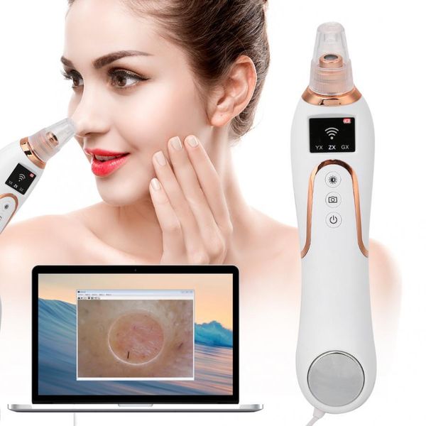3 in 1 household electric visual pore cleanser remove blackheads pimples instrument facial cleaning tools blackhead remover tool
3 in 1 household electric visual pore cleanser remove blackheads pimples instrument facial cleaning tools blackhead remover tool