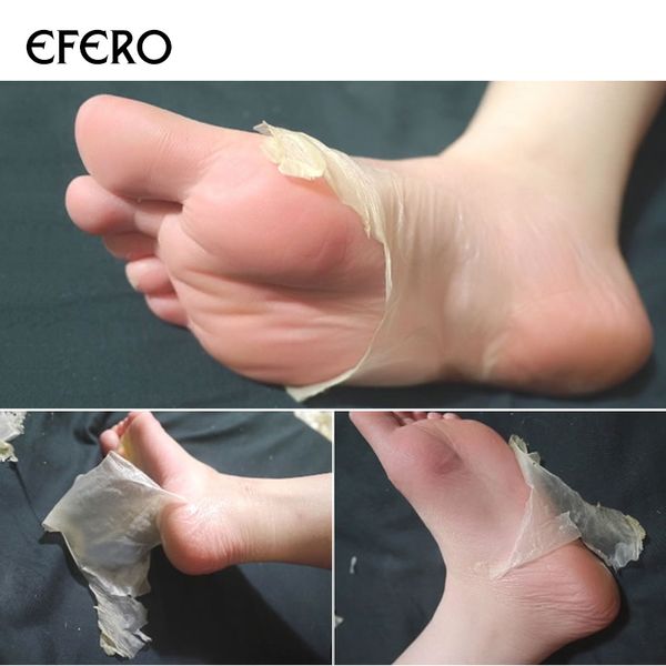 foot mask socks for pedicure baby feet exfoliating peeling mask remove dead skin exfoliation foot mask tslm1 nursing peel off to crack
foot mask socks for pedicure baby feet exfoliating peeling mask remove dead skin exfoliation foot mask tslm1 nursing peel off to crack