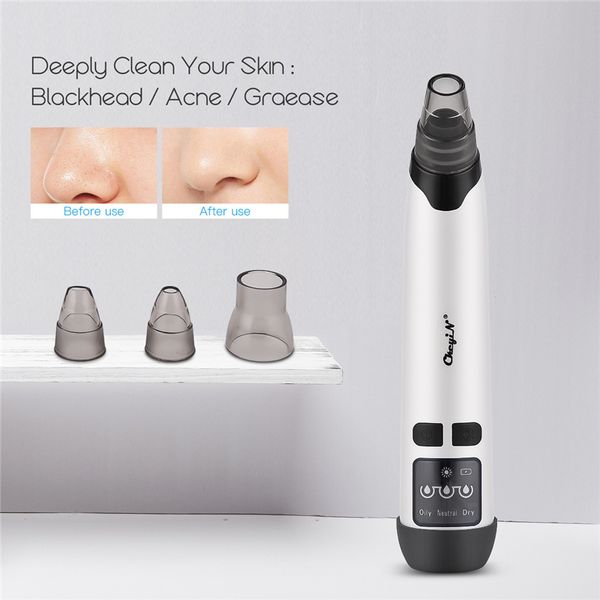 electric blackhead remover vacuum suction compress face blackhead acne comedo extractor facial pores cleaner skin care 45
electric blackhead remover vacuum suction compress face blackhead acne comedo extractor facial pores cleaner skin care 45