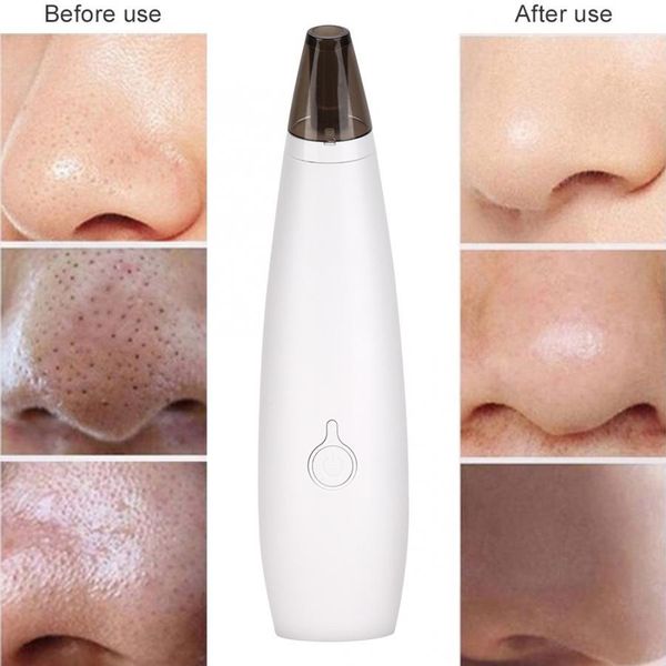 household electric blackhead removal suction face pores acne cleaning device beauty instrument for home use
household electric blackhead removal suction face pores acne cleaning device beauty instrument for home use