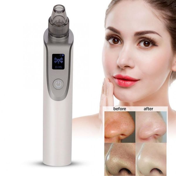 vacuum pore cleaner skin tag wart removal electric blackhead grease suction removal pore cleaner skin b
vacuum pore cleaner skin tag wart removal electric blackhead grease suction removal pore cleaner skin b