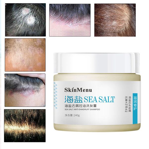 professional anti-dandruff shampoo sea salt anti-dandruff shampoo cream dandruff shampoo control oil relieve itching tslm1
professional anti-dandruff shampoo sea salt anti-dandruff shampoo cream dandruff shampoo control oil relieve itching tslm1