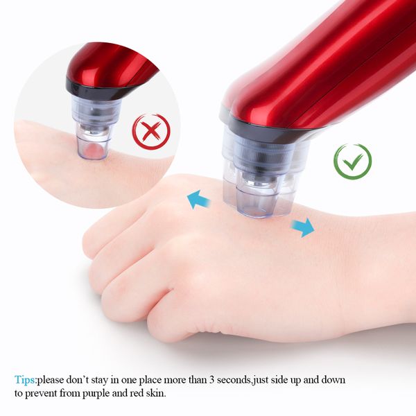 electric blackhead vacuum suction acne remover face pore spot cleaner beauty facial skin care tool face cleansing instrument
electric blackhead vacuum suction acne remover face pore spot cleaner beauty facial skin care tool face cleansing instrument