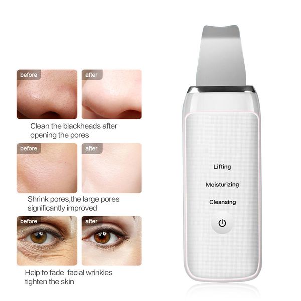 ultrasonic deep face cleaning machine ultrasonic face skin scrubber facial cleaner vibration blackhead removal exfoliating pore
ultrasonic deep face cleaning machine ultrasonic face skin scrubber facial cleaner vibration blackhead removal exfoliating pore