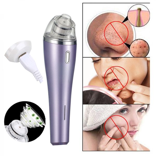 usb charging blackhead vacuum acne cleaner pore remover electric skin facial cleanser care #0305 cc
usb charging blackhead vacuum acne cleaner pore remover electric skin facial cleanser care #0305 cc
