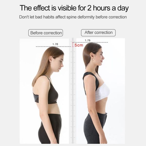 humpback correction belt correct back shaping abdomen belt prevent myopia treatment humpback orthopedic strap back support, Black;blue
humpback correction belt correct back shaping abdomen belt prevent myopia treatment humpback orthopedic strap back support, Black;blue
