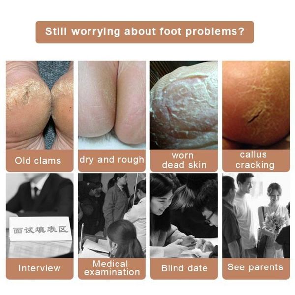 2.5cm invisible height lift heel pad sock liners increase heightened gel insole heel protector cracked foot skin care tool3, Black
2.5cm invisible height lift heel pad sock liners increase heightened gel insole heel protector cracked foot skin care tool3, Black