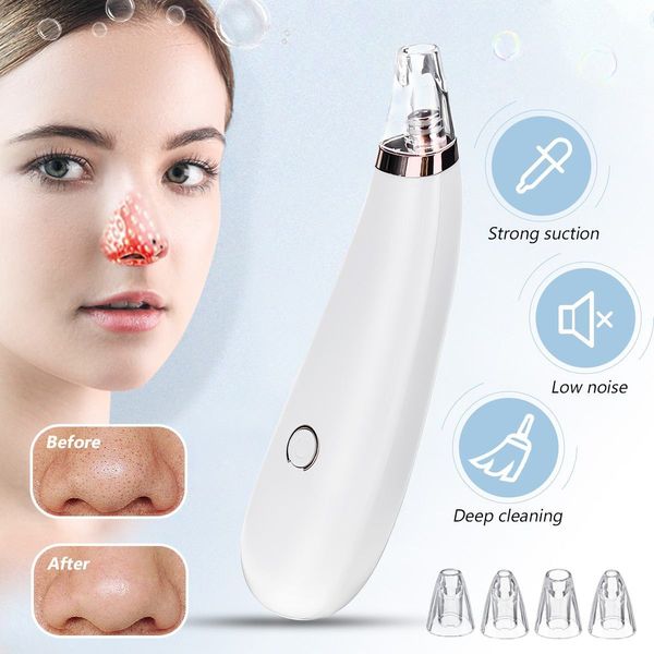 electric facial pore blackhead vacuum suction remove skin care with 4 pores blackhead remover cleaner vacuum acne cleanser
electric facial pore blackhead vacuum suction remove skin care with 4 pores blackhead remover cleaner vacuum acne cleanser
