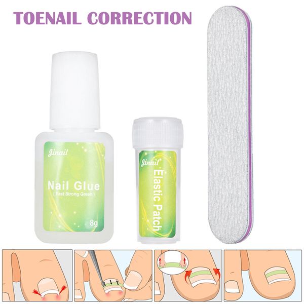 

12 pcs/bottle of ingrown toenail indent correction tool nail toe pedicure elastic patch hjl2019