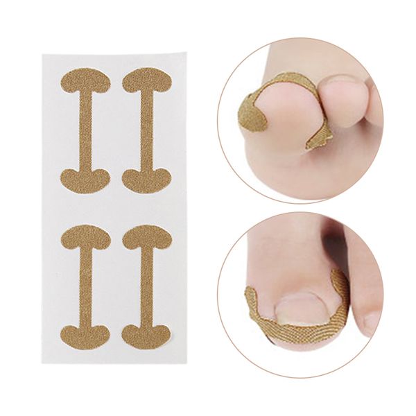 nail art kits ingrown corrector sticker fingernail treatment care repairing pedicure tools tool
nail art kits ingrown corrector sticker fingernail treatment care repairing pedicure tools tool