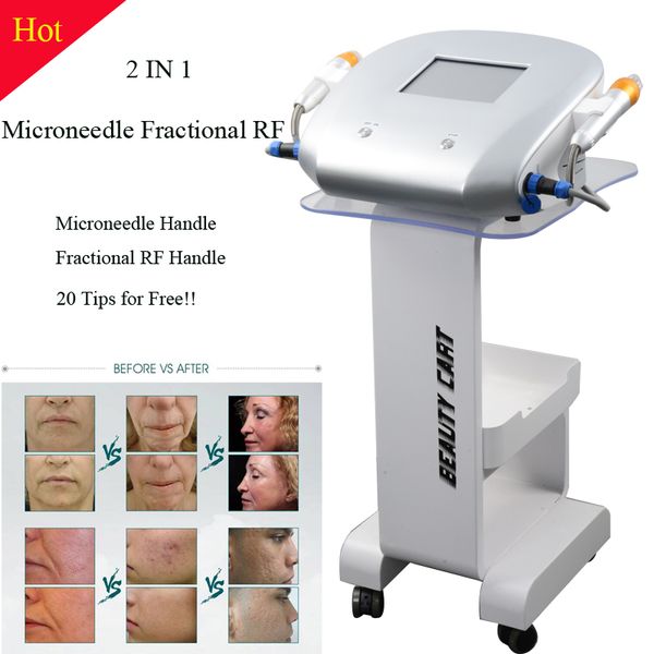 fractional microneedle rf skin rejuvenation wrinkles removal fractional micro needle machine stretch marks removal good effect 
fractional microneedle rf skin rejuvenation wrinkles removal fractional micro needle machine stretch marks removal good effect