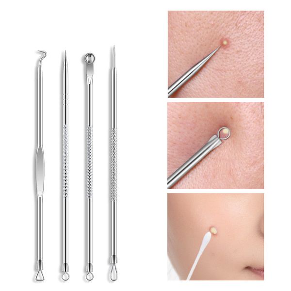 4pcs/set stainless steel acne needle blackhead comedone acne removable blemish pimple extractor tool box packing
4pcs/set stainless steel acne needle blackhead comedone acne removable blemish pimple extractor tool box packing