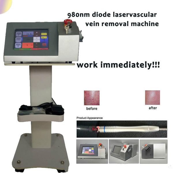 veins laser removal machine laser diode 980nm aesthetic clinic equipment medspa use machine ce/dhl
veins laser removal machine laser diode 980nm aesthetic clinic equipment medspa use machine ce/dhl