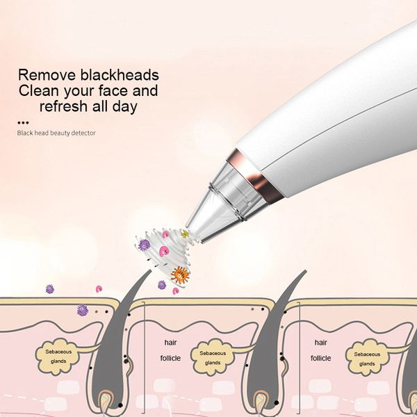 vacuum adsorption blackhead remove fast cleansing skin crush acne dry battery type for face convenient beauty instrumen
vacuum adsorption blackhead remove fast cleansing skin crush acne dry battery type for face convenient beauty instrumen