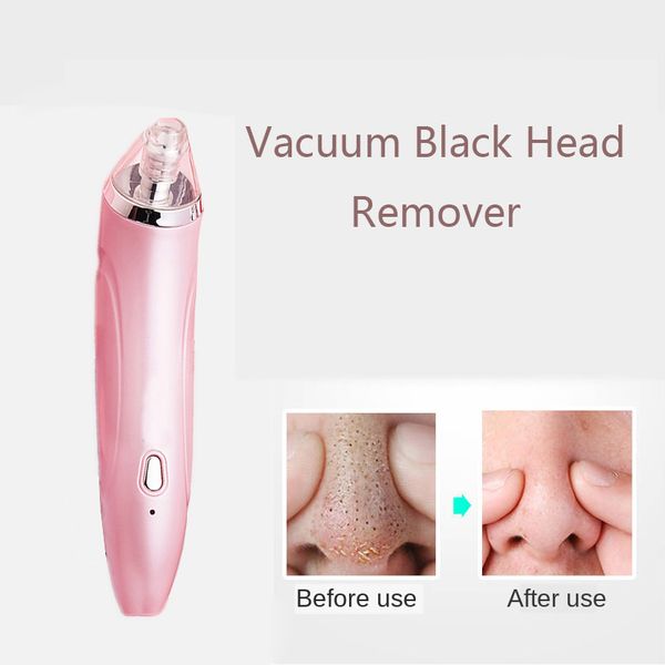 electric vacuum black head remover pores cleaner suction black dots skin care acne cleansing machine shrink pores whitening
electric vacuum black head remover pores cleaner suction black dots skin care acne cleansing machine shrink pores whitening