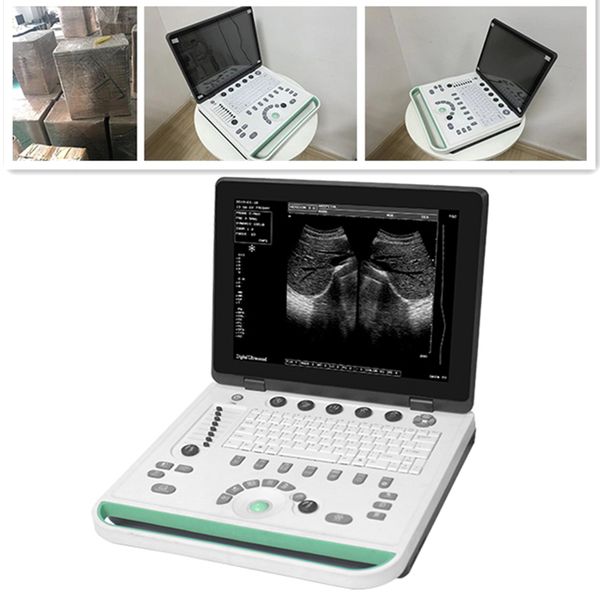 ce&iso 15inch ultrasound usg scanner/dhl ship notebook usg/ultrasonic device/factory diagnostic machine/echo device/medical usg
ce&iso 15inch ultrasound usg scanner/dhl ship notebook usg/ultrasonic device/factory diagnostic machine/echo device/medical usg