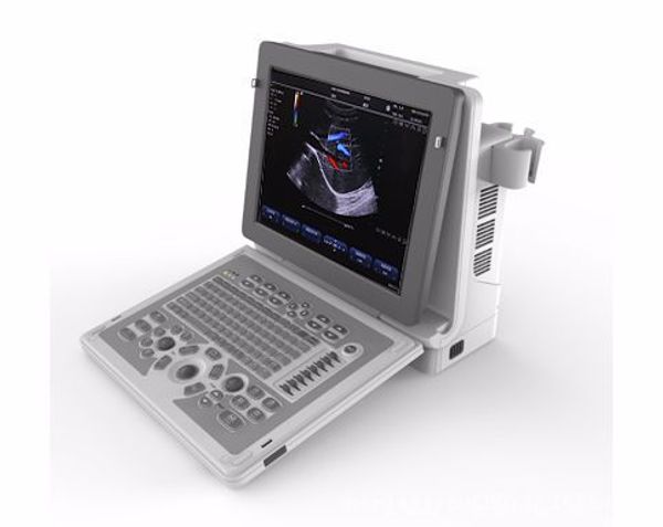 portable color doppler machine | four-dimensional color doppler ultrasonography | three-dimensional ultrasound diagnostic appara
portable color doppler machine | four-dimensional color doppler ultrasonography | three-dimensional ultrasound diagnostic appara