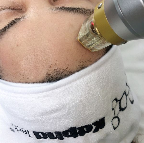 professional fractional rf microneedle face lifting machine on surgical face lift fractional rf microneedle machine for collagen induction
professional fractional rf microneedle face lifting machine on surgical face lift fractional rf microneedle machine for collagen induction