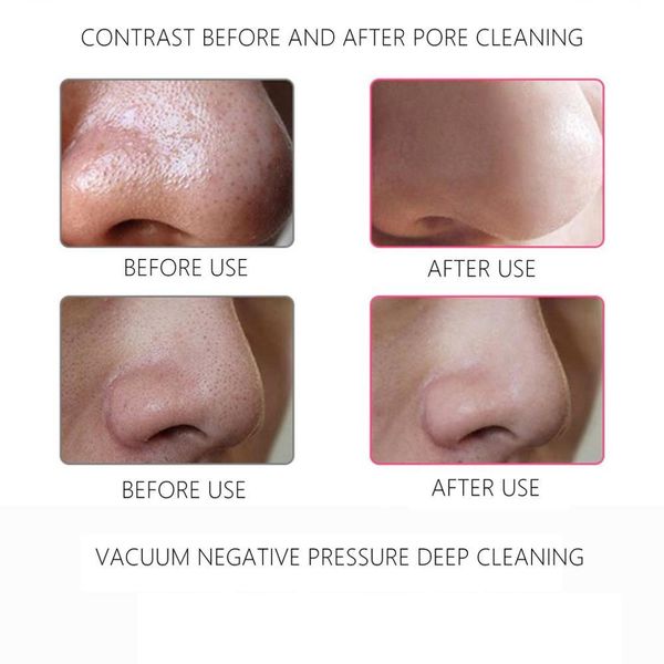 portable usb rechargeable pores vacuum electric face pore cleaner blackhead remover acne suction facial cleaning
portable usb rechargeable pores vacuum electric face pore cleaner blackhead remover acne suction facial cleaning
