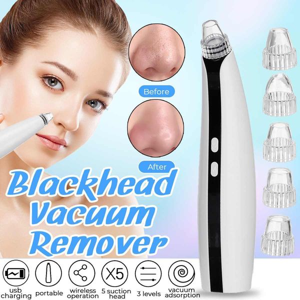 electric vacuum pore cleaner wireless electric blackhead remover usb rechargeable face nose cleaning machine w/ 5 suction
electric vacuum pore cleaner wireless electric blackhead remover usb rechargeable face nose cleaning machine w/ 5 suction