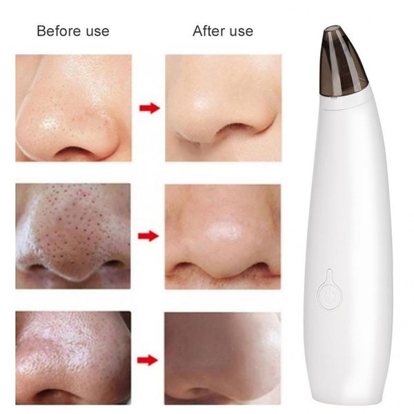 remover blackhead cleaner household electric blackhead removal suction face pores cleaning vacuum suction device instrument
remover blackhead cleaner household electric blackhead removal suction face pores cleaning vacuum suction device instrument