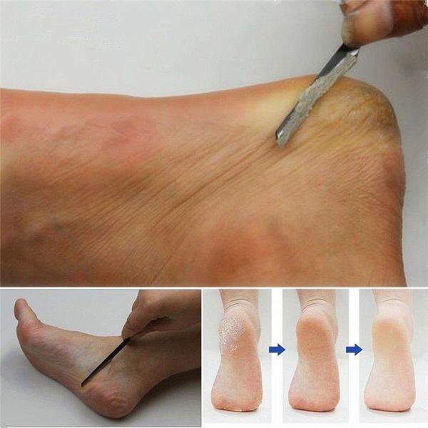 1pc tungsten steel foot rasp pedicure / manicure nail cleaner cuticle grooming dead skin planer black foot rasp
1pc tungsten steel foot rasp pedicure / manicure nail cleaner cuticle grooming dead skin planer black foot rasp