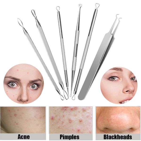 6pcs stainless steel blackhead pimples acne needle tool kit with bag whitehead pimple acne blemish comedone extractor 2u81114
6pcs stainless steel blackhead pimples acne needle tool kit with bag whitehead pimple acne blemish comedone extractor 2u81114