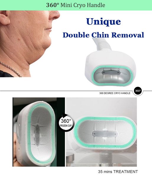 360 cryo double chin removal mini handle submental fat removal small body part fat reduction mini cryo
360 cryo double chin removal mini handle submental fat removal small body part fat reduction mini cryo