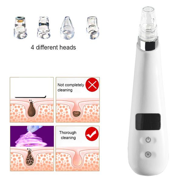 blackhead remover vacuum facial pore cleaner skin care comedone extraction kit remover tools electronic led display
blackhead remover vacuum facial pore cleaner skin care comedone extraction kit remover tools electronic led display