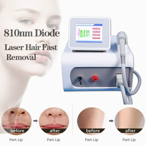 2020 portable 808nm diode laser hair removal machine facial hair removal equipment diode laser light
2020 portable 808nm diode laser hair removal machine facial hair removal equipment diode laser light