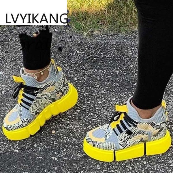 2020 casual shoes woman fashion mixed colors platform sneakers trainers women flat shoes zapatos de mujer womens sneaker basket, Black
2020 casual shoes woman fashion mixed colors platform sneakers trainers women flat shoes zapatos de mujer womens sneaker basket, Black
