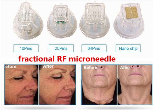 disposable replacement 10/25/64/nano pin head gold cartridge fractional rf microneedle microneedling micro needle machine cartridges tips
disposable replacement 10/25/64/nano pin head gold cartridge fractional rf microneedle microneedling micro needle machine cartridges tips