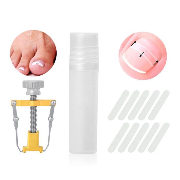 repairing fixer device protector straightening clip ingrown embed pedicure toenail correction tool set foot care patch brace
repairing fixer device protector straightening clip ingrown embed pedicure toenail correction tool set foot care patch brace