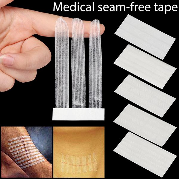 1 set 5 sizes seam-beauty tape surgery postpartum skin wound strip pull tight anti-speed safety survival tape
1 set 5 sizes seam-beauty tape surgery postpartum skin wound strip pull tight anti-speed safety survival tape