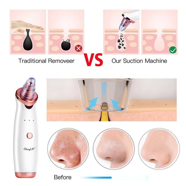 electric vacuum suction cleaner face cleaning blackhead removal black spot facial cleansing machine skin scrubber pore cleanser
electric vacuum suction cleaner face cleaning blackhead removal black spot facial cleansing machine skin scrubber pore cleanser