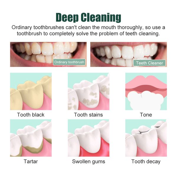 rechargeableportableoralcleanerirrigatorforteethteethwhitenerdentalwaterjetdentalcleaningteethtoolwaterproof raben
rechargeableportableoralcleanerirrigatorforteethteethwhitenerdentalwaterjetdentalcleaningteethtoolwaterproof raben