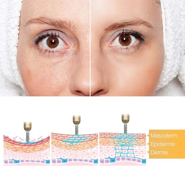 2 in 1 new high pressure hyaluronic pen 2 in 1no needle hyaluron pen for tattoo tip hyaluron gun 0.3ml &0.5ml head perfectio
2 in 1 new high pressure hyaluronic pen 2 in 1no needle hyaluron pen for tattoo tip hyaluron gun 0.3ml &0.5ml head perfectio