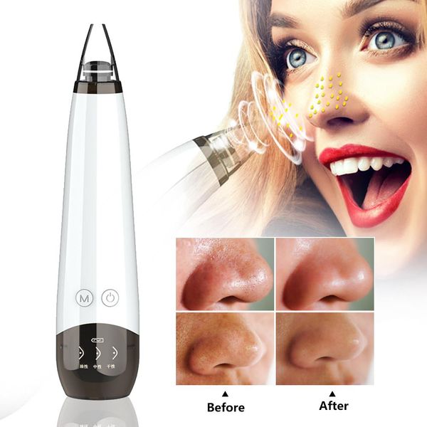 rechargeable removedor skin usb blackhead cleaner acne tag remover pore plasma care pen cravo tools de vacuum mwtwuz rimmer
rechargeable removedor skin usb blackhead cleaner acne tag remover pore plasma care pen cravo tools de vacuum mwtwuz rimmer