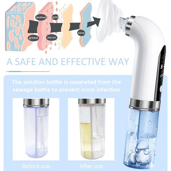 electric vacuum blackhead acne pore cleaner water cycle skin deep cleaning usb rechargeable small bubbles beauty care tools perfections
electric vacuum blackhead acne pore cleaner water cycle skin deep cleaning usb rechargeable small bubbles beauty care tools perfections